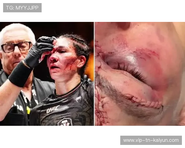 UFC拳手满脸鲜血仍坚持战斗：血性格斗背后的钢铁意志